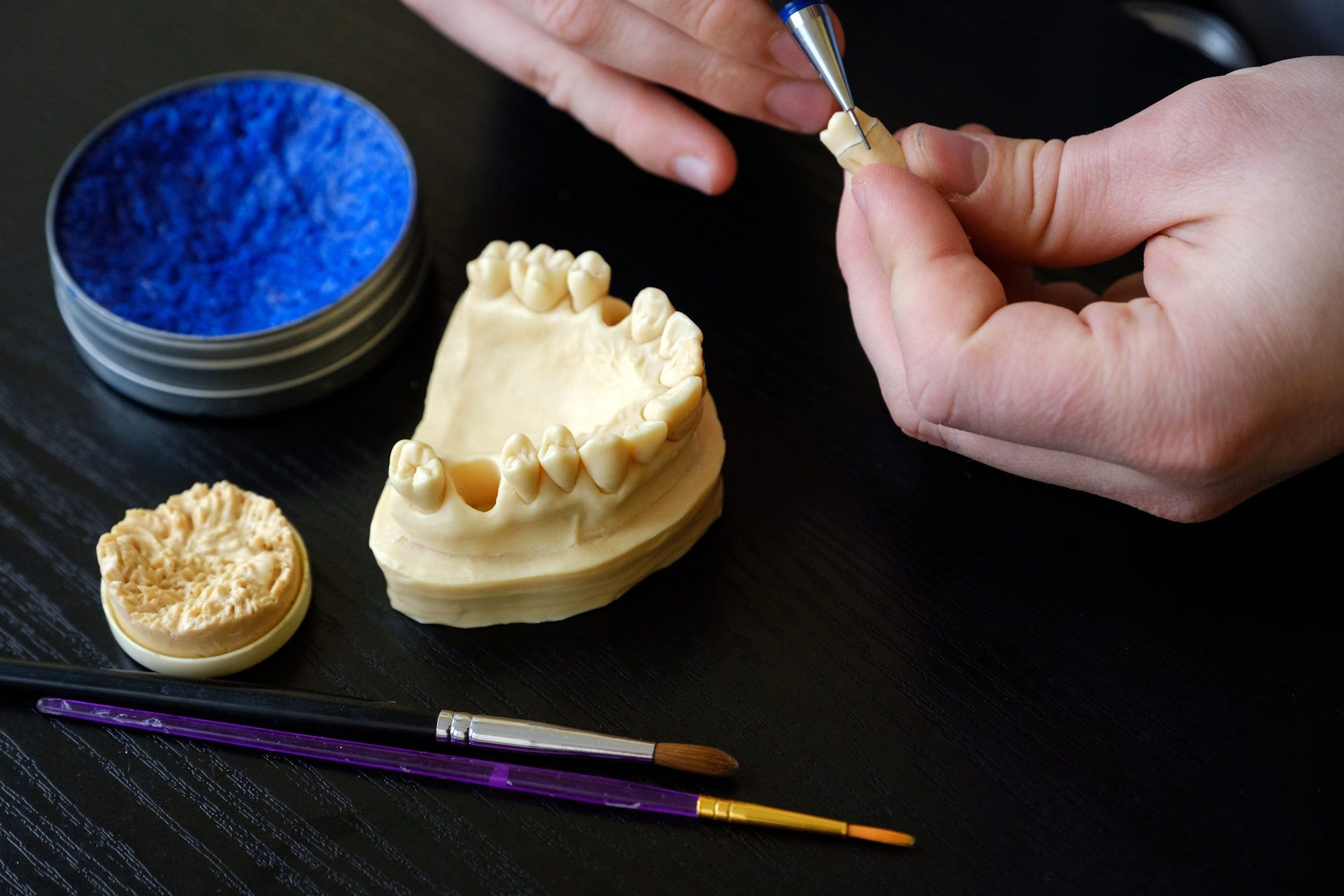 Wie werden Zahnimplantate hergestellt